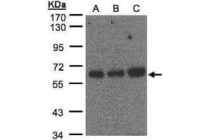 WB Image Sample(30 μg of whole cell lysate) A:Hep G2, B:MOLT4, C: Raji , 7. (PUF60 抗体  (C-Term))