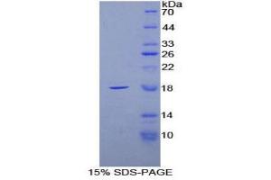SDS-PAGE (SDS) image for Fatty Acid Binding Protein 4, Adipocyte (FABP4) (AA 2-132) protein (His tag) (ABIN1879302)