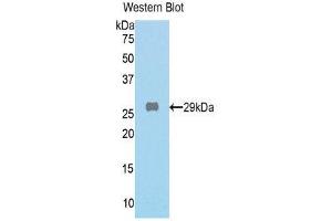 Western Blotting (WB) image for anti-Galactosidase, beta 1 (GLB1) (AA 192-432) antibody (ABIN1859021) (GLB1 抗体  (AA 192-432))