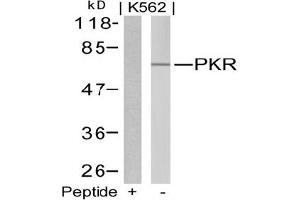Image no. 1 for anti-Eukaryotic Translation Initiation Factor 2-alpha Kinase 2 (EIF2AK2) (Thr446) antibody (ABIN197544) (EIF2AK2 抗体  (Thr446))