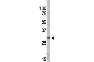 Western blot analysis of SIRT5 antibody in Jurkat lysate (SIRT5 抗体  (AA 263-292))