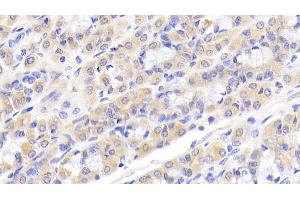 Detection of CALR in Human Stomach Tissue using Polyclonal Antibody to Calreticulin (CALR) (Calreticulin 抗体  (AA 196-310))