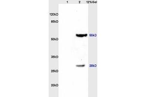 Lane 1: rat brain lysates Lane 2: rat heart lysates probed with Anti TXNRD1 Polyclonal Antibody, Unconjugated (ABIN1386102) at 1:200 in 4 °C.