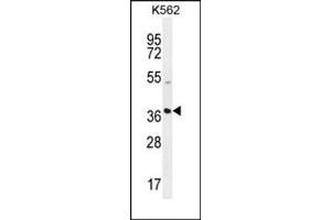 Western blot analysis using SFRP4 Antibody (C-term) Cat. (SFRP4 抗体  (C-Term))