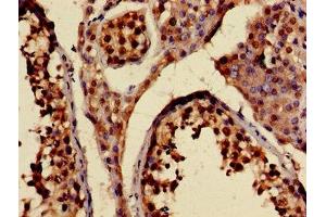 Immunohistochemistry of paraffin-embedded human testis tissue using ABIN7157612 at dilution of 1:100 (KIF2A 抗体  (AA 161-294))