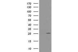 Western Blotting (WB) image for anti-Adenylate Kinase 3 (AK3) antibody (ABIN1496522) (Adenylate Kinase 3 抗体)
