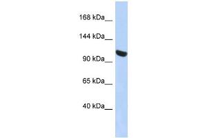 UBA1 antibody used at 1 ug/ml to detect target protein. (UBA1 抗体  (N-Term))