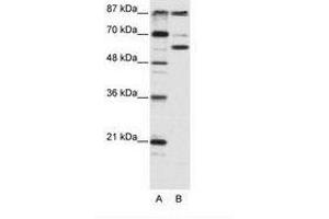 Image no. 1 for anti-K(lysine) Acetyltransferase 2B (KAT2B) (AA 190-239) antibody (ABIN202927) (KAT2B 抗体  (AA 190-239))