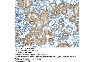 Rabbit Anti-TRNT1 Antibody  Paraffin Embedded Tissue: Human Kidney Cellular Data: Epithelial cells of renal tubule Antibody Concentration: 4. (Trnt1 抗体  (N-Term))