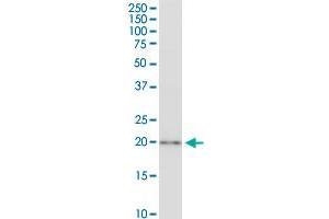 Western Blotting (WB) image for anti-Cysteine and Glycine-Rich Protein 3 (CSRP3) (AA 95-194) antibody (ABIN563533)