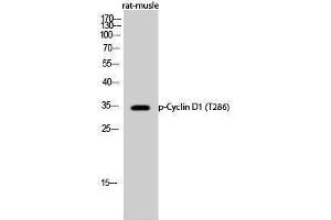 Western Blotting (WB) image for anti-Cyclin D1 (CCND1) (pThr286) antibody (ABIN3172999) (Cyclin D1 抗体  (pThr286))