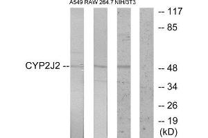 Western Blotting (WB) image for anti-Cytochrome P450, Family 2, Subfamily J, Polypeptide 2 (CYP2J2) (Internal Region) antibody (ABIN1850360) (CYP2J2 抗体  (Internal Region))