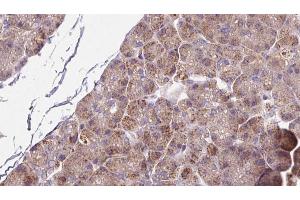 Immunohistochemistry (IHC) image for anti-Solute Carrier Family 39 (Zinc Transporter), Member 6 (SLC39A6) (Internal Region) antibody (ABIN6262982)
