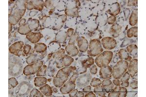 Immunoperoxidase of monoclonal antibody to FBXL18 on formalin-fixed paraffin-embedded human salivary gland. (FBXL18 抗体  (AA 1-110))