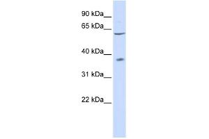 WB Suggested Anti-P2RX2 Antibody Titration:  0. (P2RX2 抗体  (N-Term))