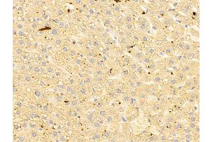 ABIN6263141 and ABIN6273054 at 1/100 staining Rat liver tissue by IHC-P.