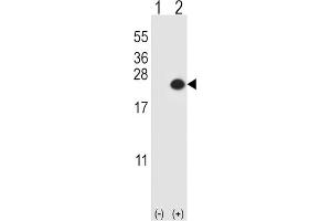 Western Blotting (WB) image for anti-Dual Specificity Phosphatase 3 (DUSP3) antibody (ABIN3003774) (Dual Specificity Phosphatase 3 (DUSP3) 抗体)