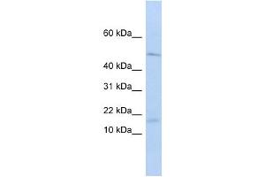 VPREB1 antibody used at 1 ug/ml to detect target protein. (VPREB1 抗体  (Middle Region))