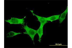 Immunofluorescence (IF) image for anti-Doublecortin-Like Kinase 1 (DCLK1) (AA 640-729) antibody (ABIN563973)