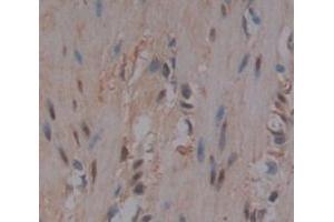 Used in DAB staining on fromalin fixed paraffin- embedded skeletal muscle tissue (FLII 抗体  (AA 896-1176))