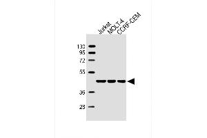 Lane 1: Jurkat, Lane 2: MOLT-4, Lane 3: CCRF-CEM cell lysate at 20 µg per lane, probed with bsm-51447M ADA (608CT2. (ADA 抗体)