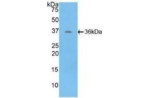 Detection of Recombinant ATP6AP2, Human using Polyclonal Antibody to ATPase, H+ Transporting, Lysosomal Accessory Protein 2 (ATP6AP2) (ATP6AP2 抗体  (AA 17-302))