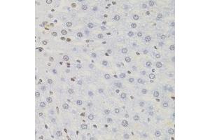 Immunohistochemistry of paraffin-embedded rat liver using AKAP8 antibody (ABIN5975842) (40x lens). (AKAP8 抗体)