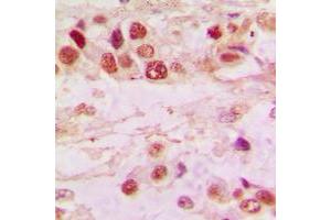 Immunohistochemistry (IHC) image for anti-Histone Deacetylase 7 (HDAC7) (C-Term) antibody (ABIN7298164)