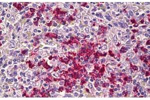 Anti-CDH23 antibody IHC staining of human spleen. (CDH23 抗体  (AA 61-110))