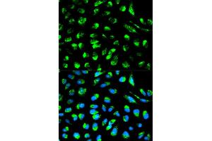 Immunofluorescence analysis of HeLa cells using ECI1 antibody (ABIN5970553). (DCI 抗体)