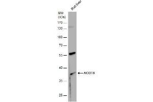 WB Image ACOT8 antibody detects ACOT8 protein by western blot analysis. (ACOT8 抗体)