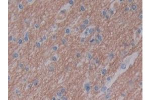 Detection of GZMB in Human Cerebrum Tissue using Polyclonal Antibody to Granzyme B (GZMB) (GZMB 抗体  (AA 21-247))