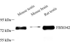 Western blot analysis of FBXO42 (ABIN7073905) at dilution of 1: 200 (FBXO42 抗体)