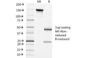 SDS-PAGE Analysis Purified LHCGR Mouse Monoclonal Antibody (LHCGR/1415). (LHCGR 抗体  (AA 70-410))