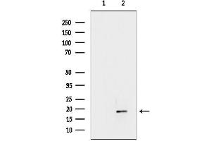 anti-Arachidonate 5-Lipoxygenase-Activating Protein (ALOX5AP) (Internal Region) antibody
