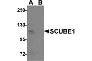 Western blot analysis of SCUBE1 in Daudi cell lysate with SCUBE1 antibody at 1 μg/ml in (A) the absence and (B) the presence of blocking peptide. (SCUBE1 抗体  (Center))