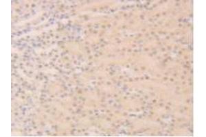 Detection of SIRT6 in Mouse Kidney Tissue using Polyclonal Antibody to Sirtuin 6 (SIRT6) (SIRT6 抗体  (AA 1-334))
