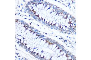 Immunohistochemistry of paraffin-embedded Human colon using FD Rabbit pAb (ABIN7267116) at dilution of 1:50 (40x lens). (FAM3D 抗体  (AA 24-204))