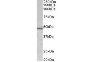 AP31711PU-N (1µg/ml) staining of Daudi lysate (35µg protein in RIPA buffer). (Chitotriosidase 1 抗体  (Internal Region))