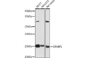Western blot analysis of extracts of various cell lines, using CR Rabbit mAb (ABIN7266269) at 1:1000 dilution. (CRABP1 抗体)