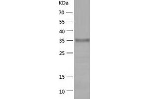 Western Blotting (WB) image for C-Type Lectin Domain Family 14, Member A (CLEC14A) (AA 22-398) protein (His tag) (ABIN7122062) (CLEC14A Protein (AA 22-398) (His tag))