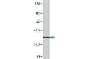 Western Blot detection against Immunogen (37. (PDIA4 抗体  (AA 355-464))