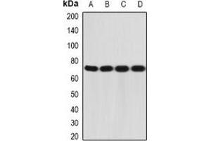Western blot analysis of CD212 expression in A431 (A), MCF7 (B), mouse liver (C), mouse thymus (D) whole cell lysates. (IL12RB1 抗体)