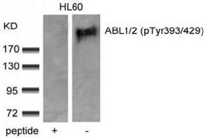Image no. 3 for anti-Abelson Murine Leukemia Viral Oncogene Homolog 1/2 (ABL1/ABL2) (pTyr393), (pTyr439) antibody (ABIN319285) (ABL1/2 抗体  (pTyr393, pTyr439))