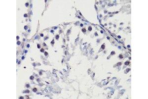 Immunohistochemistry of paraffin-embedded Rat testis using p27 KIP 1 Polyclonal Antibody at dilution of 1:100 (40x lens). (CDKN1B 抗体)