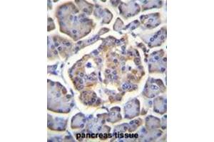 BTBD17 Antibody (C-term) immunohistochemistry analysis in formalin fixed and paraffin embedded human pancreas tissue followed by peroxidase conjugation of the secondary antibody and DAB staining. (BTBD17 抗体  (C-Term))
