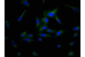 Immunofluorescence staining of Hela cells with ABIN7163899 at 1:200, counter-stained with DAPI. (POPDC3 抗体  (AA 130-291))
