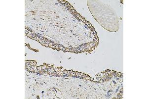 Immunohistochemistry of paraffin-embedded human prostate using ABCC3 antibody (ABIN6003581) at dilution of 1/100 (40x lens). (ABCC3 抗体)