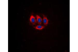 Immunofluorescent analysis of BMX (pY566) staining in HeLa cells. (BMX 抗体  (C-Term, pTyr566))