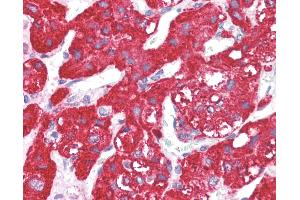 Immunohistochemistry (IHC) image for anti-Activin Receptor Type 1C (ACVR1C) (N-Term) antibody (ABIN1099825)